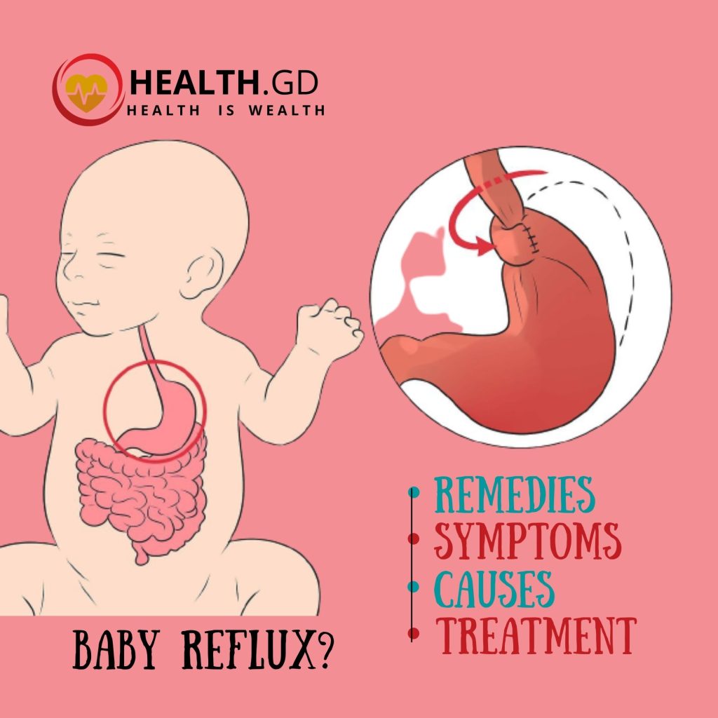 Baby Reflux Remedies