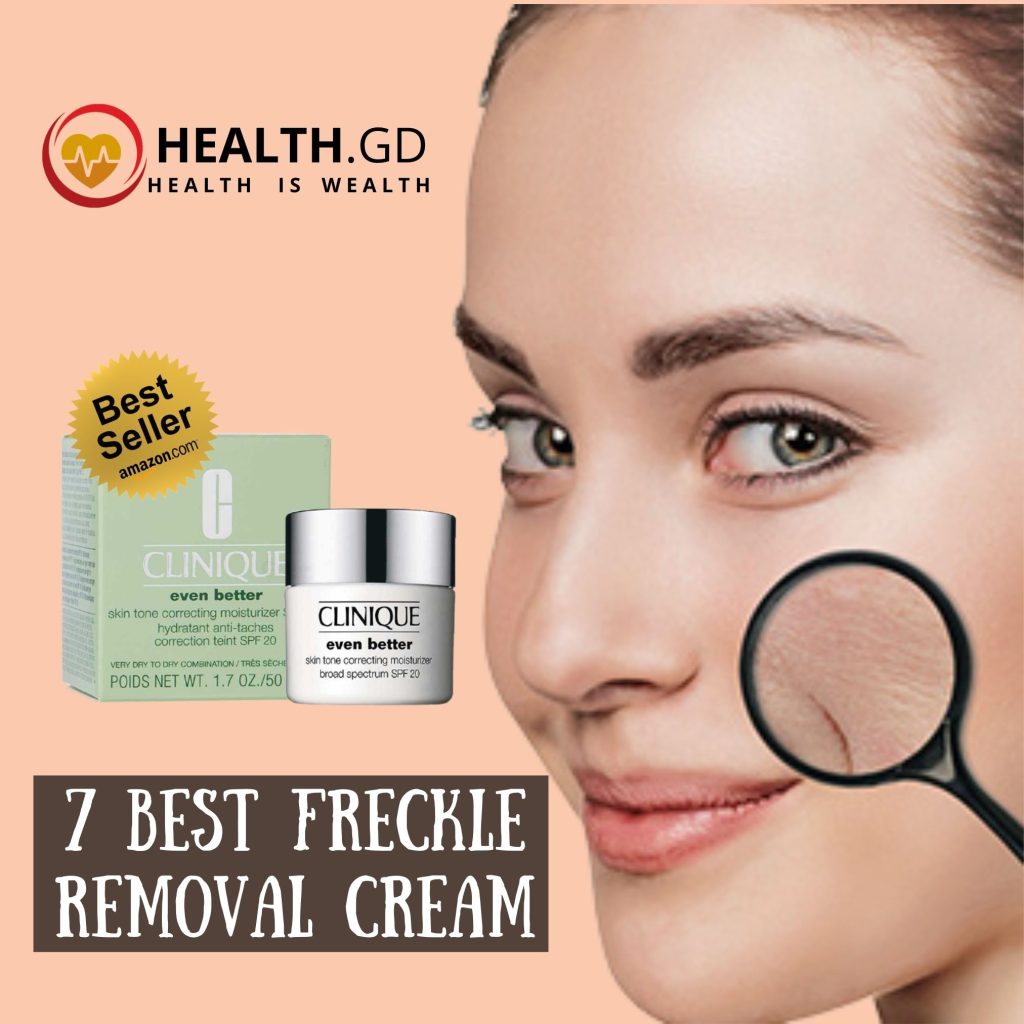 best freckle removal cream