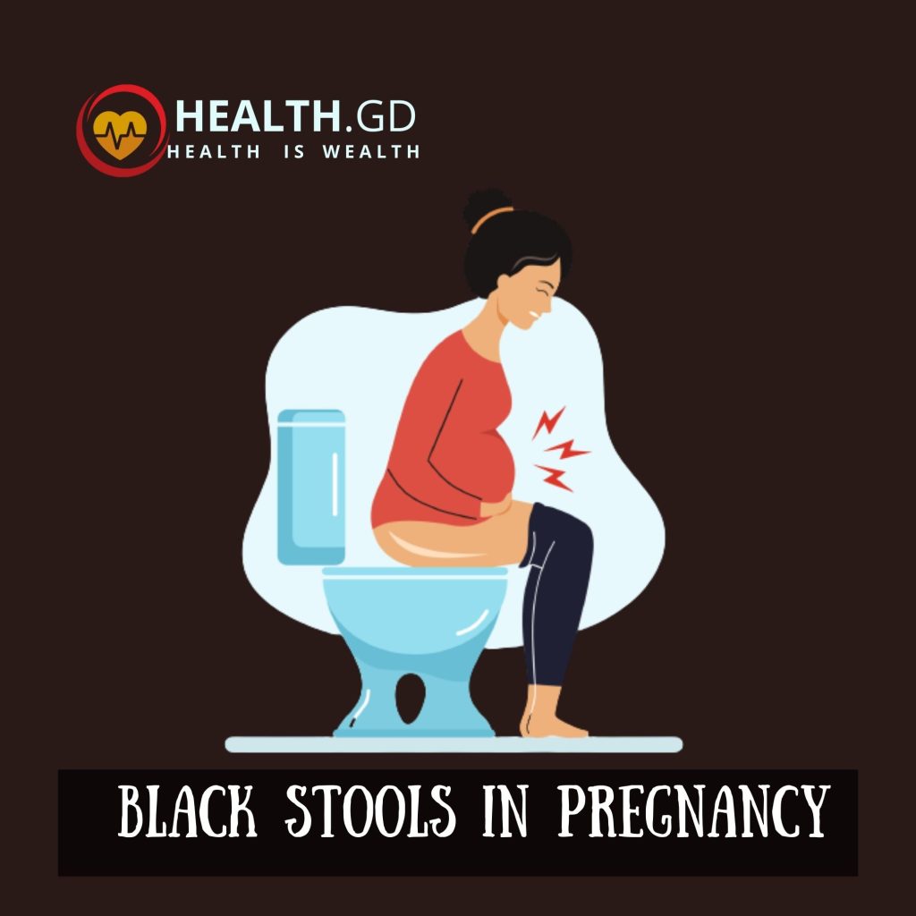 Black stools in pregnancy