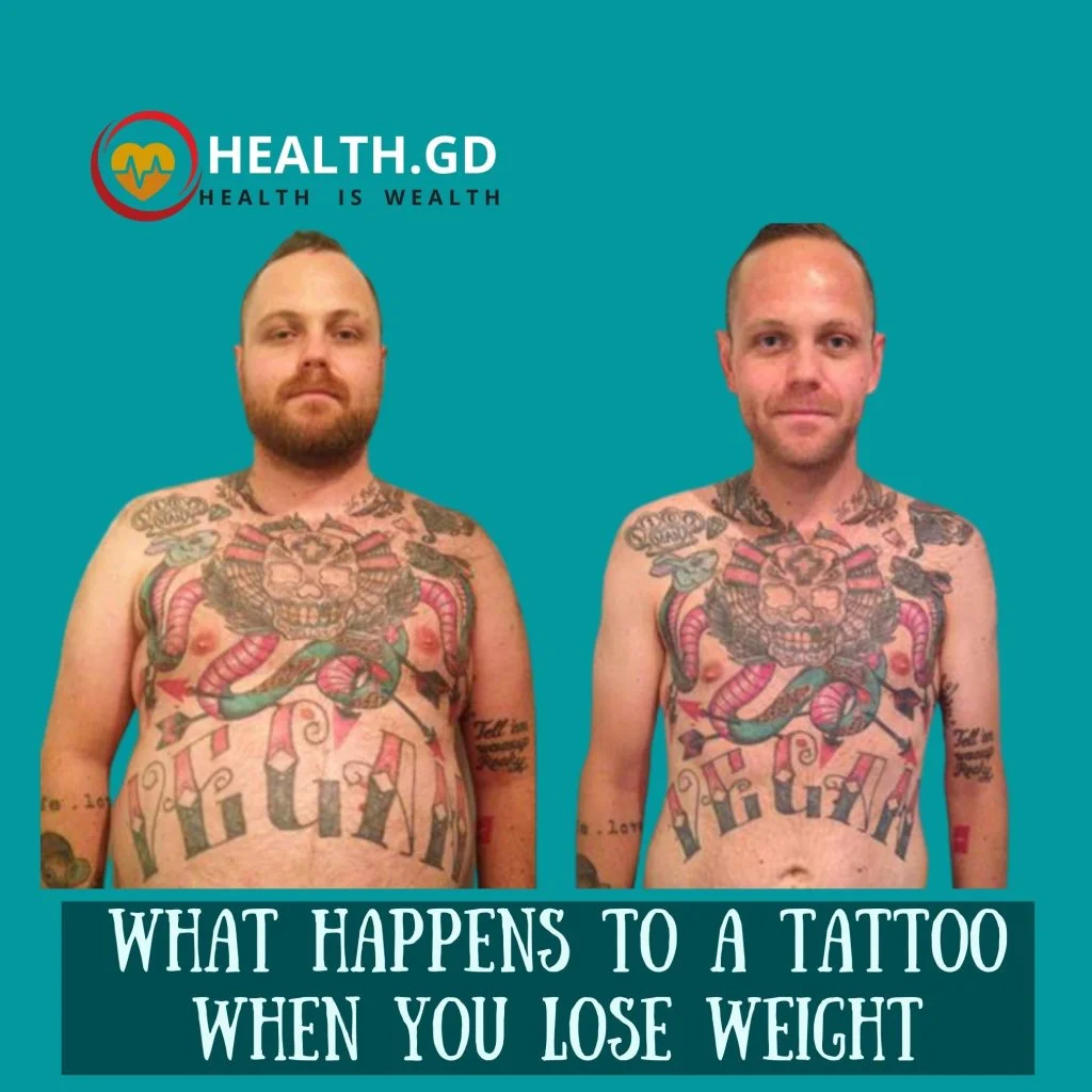 what happens to a tattoo when you lose weight