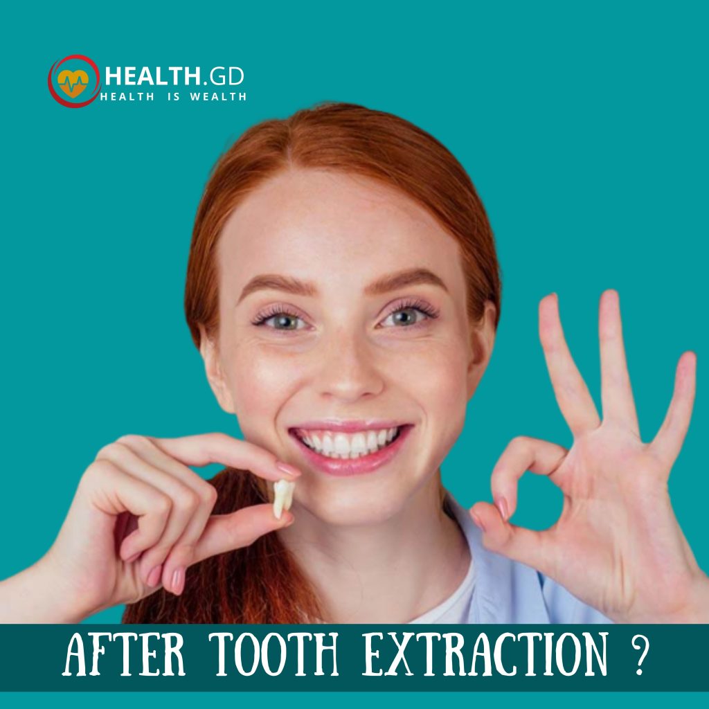 What to do after tooth extraction?