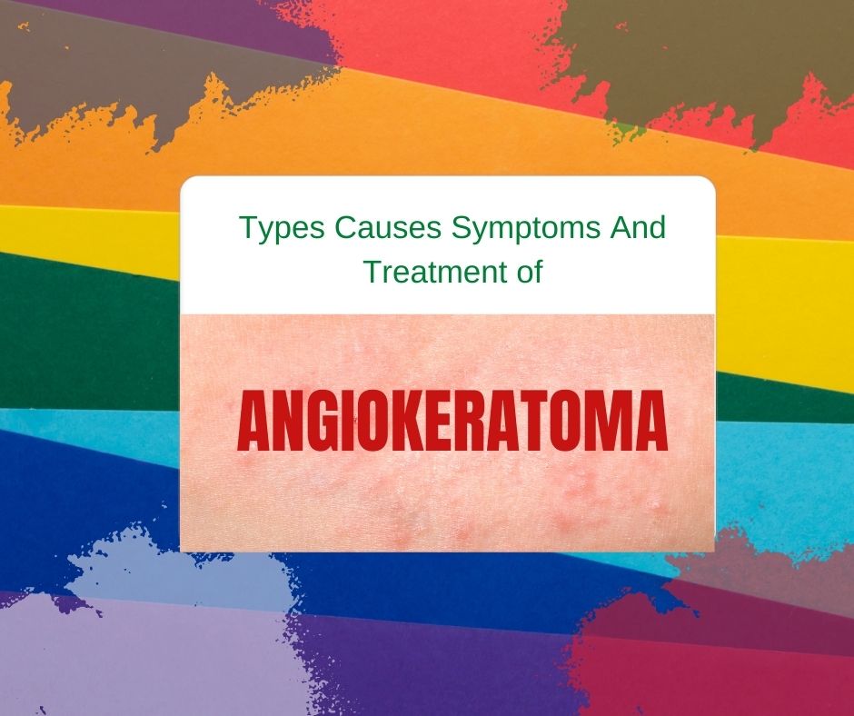 What is Angiokeratoma
