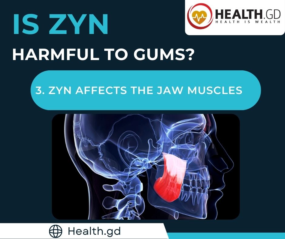 Is ZYN harmful to Gums ZYN Affects the Jaw Muscles
