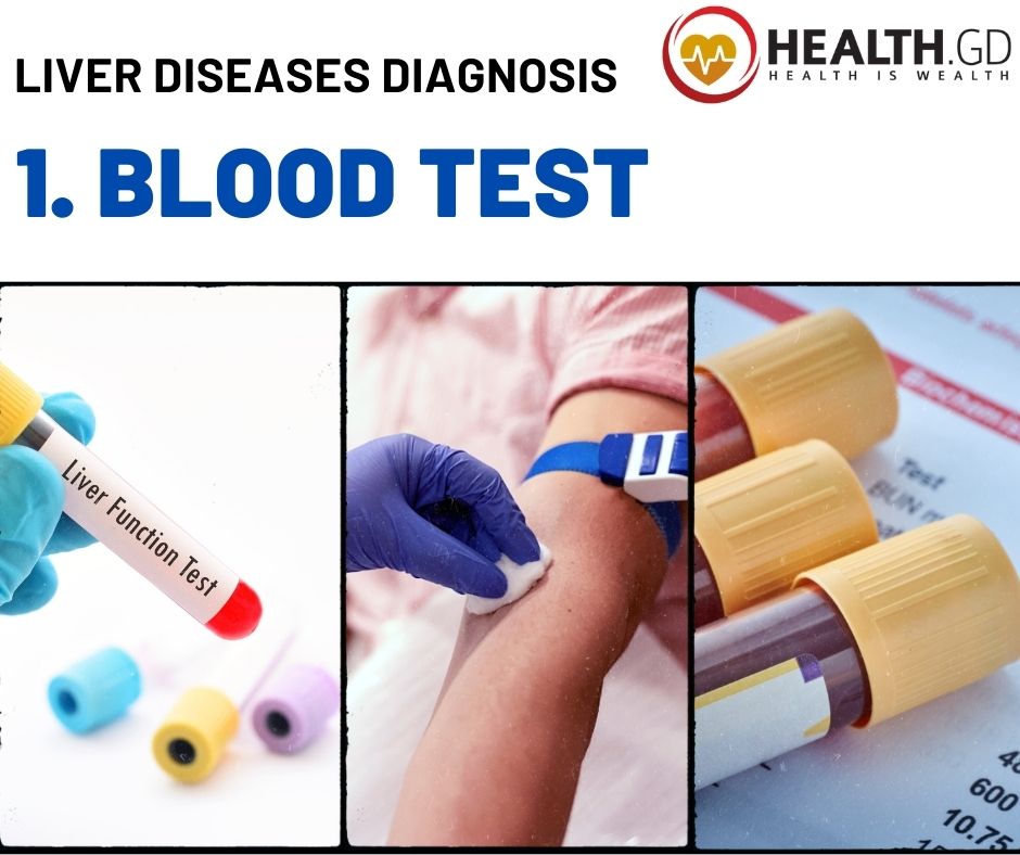 Liver Diseases by Diagnosis Blood Test