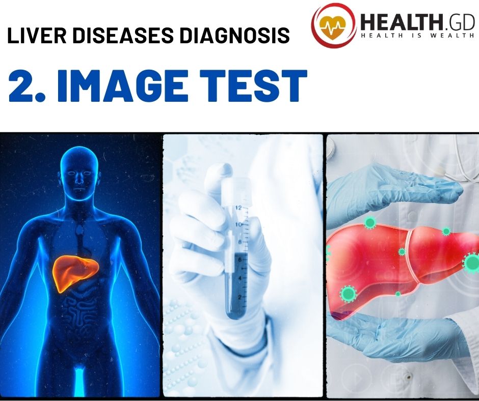 Liver Diseases by Diagnosis Image Test