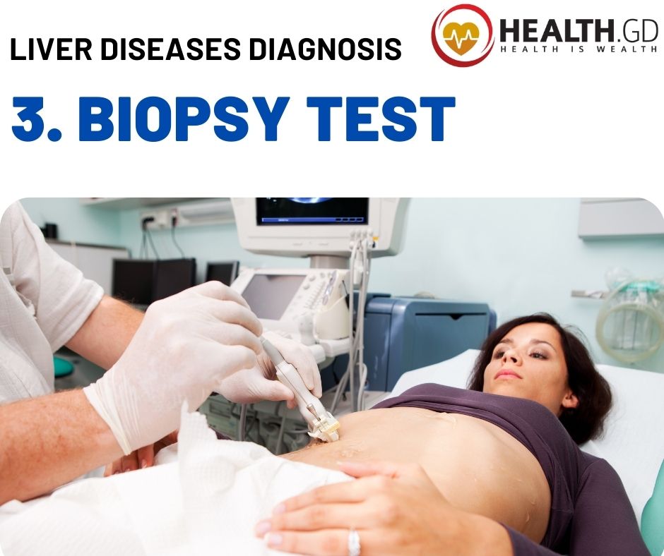 Liver Diseases by Diagnosis Liver Biopsy