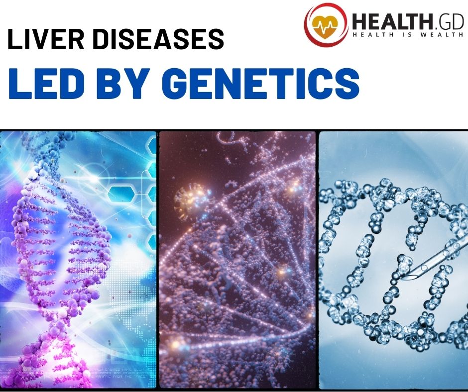 Liver Diseases by Genetics