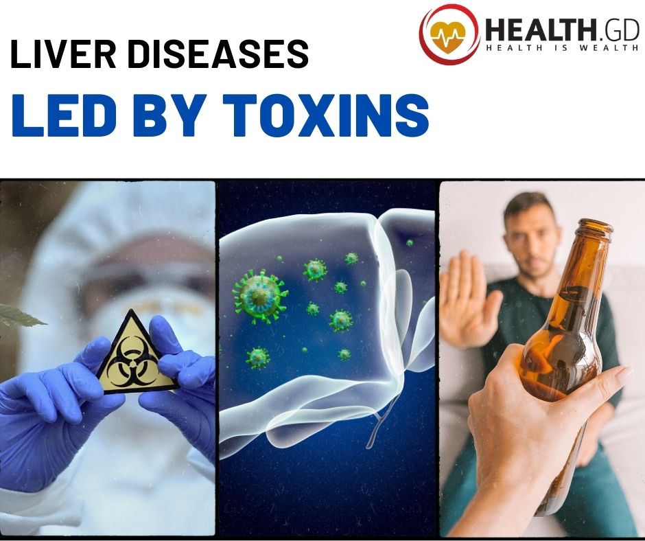 Liver Diseases by Toxins