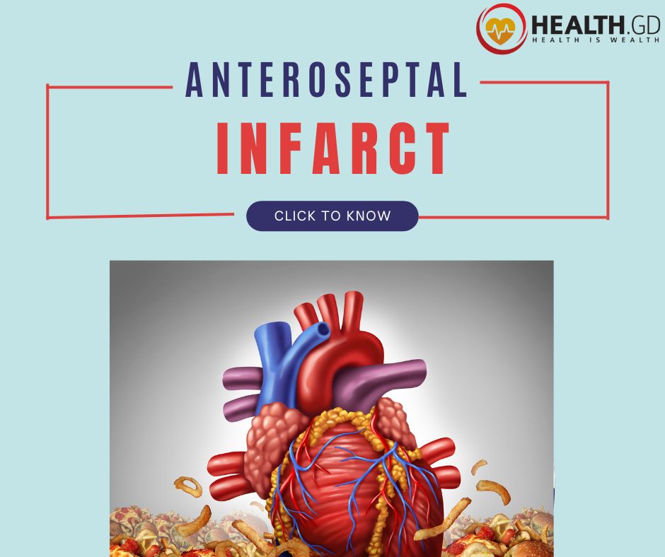 Anteroseptal Infarct