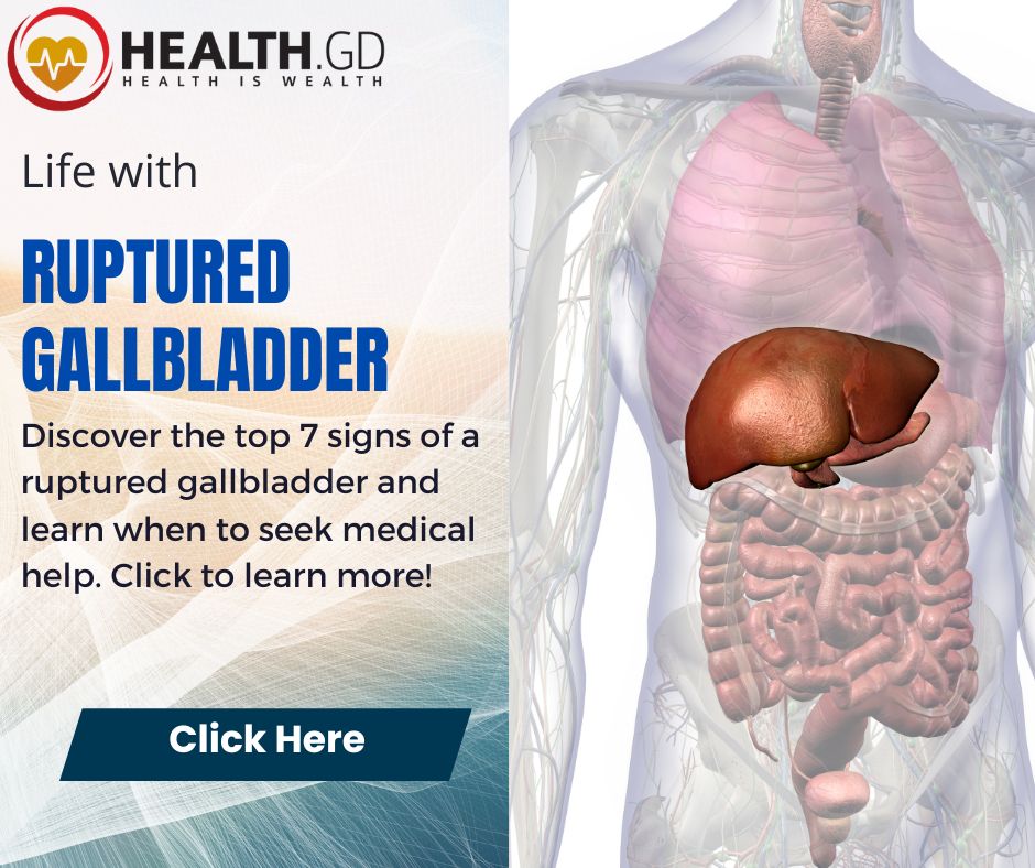 how long can you live with a ruptured gallbladder